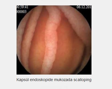 Ad:  3.JPG
Gsterim: 2614
Boyut:  19.3 KB