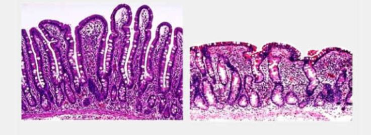 Ad:  4.JPG
Gsterim: 2896
Boyut:  50.7 KB