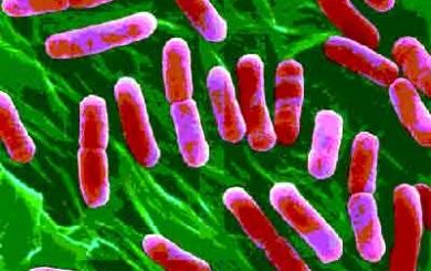 Ad:  Bakteri-4.jpg
Gsterim: 3965
Boyut:  25.5 KB