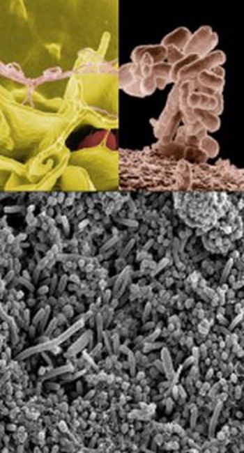 Ad:  Bakteriler-10.jpg
Gsterim: 3260
Boyut:  46.4 KB