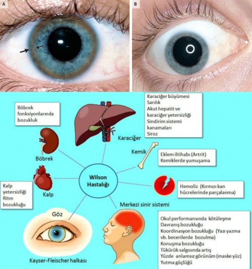 Ad:  Wilson hastal.jpg
Gsterim: 5362
Boyut:  50.5 KB