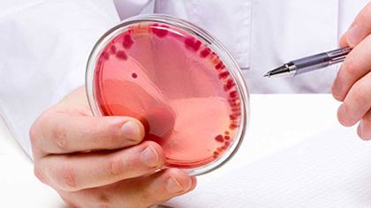 Ad:  hematoloji-3.jpg
Gsterim: 698
Boyut:  14.6 KB