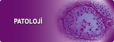 Ad:  pataloji.jpg
Gsterim: 904
Boyut:  8.9 KB