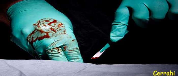 Ad:  cerrah.jpg
Gsterim: 508
Boyut:  50.6 KB