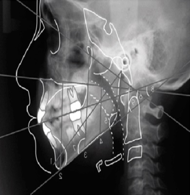 Ad:  cerrahi operasyon.jpg
Gsterim: 440
Boyut:  40.2 KB