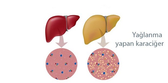 Ad: kimler-karaciger-yaglanmasi-riski-altinda,FJ1W550kR06eBtDI2HQIfw.jpg
Gösterim: 1048
Boyut: 29.8 KB