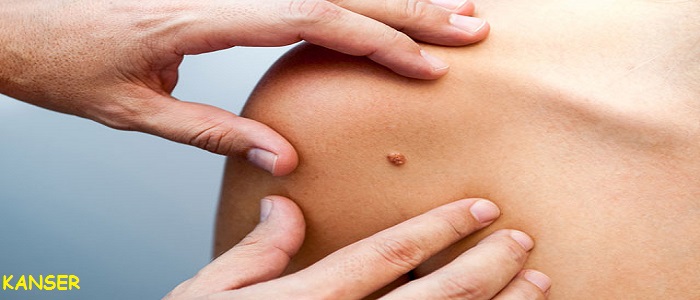 Ad:  benler ve kanser.jpg
Gsterim: 744
Boyut:  61.8 KB