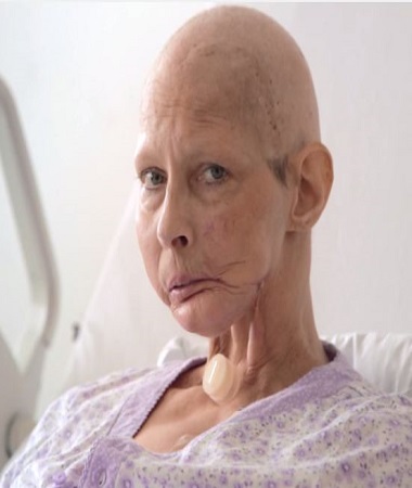 Ad:  sigarakanser.jpg
Gsterim: 2002
Boyut:  44.7 KB