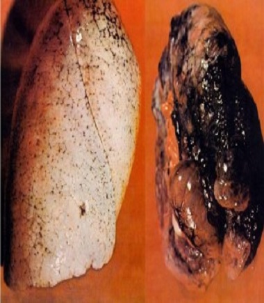 Ad:  akcier.jpg
Gsterim: 1924
Boyut:  57.7 KB