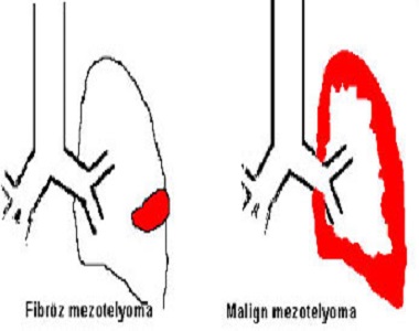 Ad:  akcierrr.jpg
Gsterim: 1022
Boyut:  41.9 KB