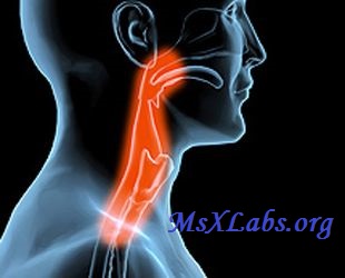 Ad: Gırtlak Kanseri-2.jpg
Gösterim: 1690
Boyut: 19.5 KB