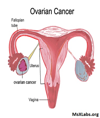 Ad: over kanseri.jpg
Gösterim: 1897
Boyut: 44.9 KB