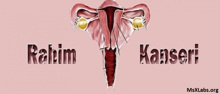 Ad:  rahim kanseri.jpg
Gsterim: 831
Boyut:  38.3 KB