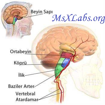 Ad:  beyin sap.jpg
Gsterim: 1018
Boyut:  36.0 KB