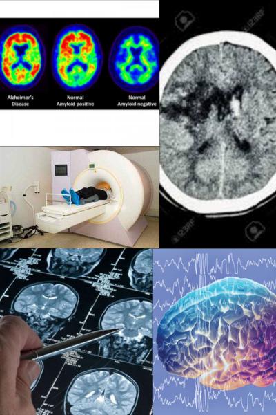 Ad: Beyin taraması.jpg
Gösterim: 509
Boyut: 49.6 KB