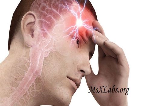 Ad:  Beyin Kanamas.jpg
Gsterim: 368
Boyut:  25.0 KB