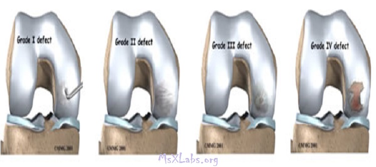 Ad: gonartroz-kikirdak-incelme-evreleri.jpg
Gösterim: 691
Boyut: 55.1 KB