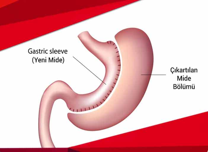 Ad:  mide-2-1.jpg
Gsterim: 534
Boyut:  15.4 KB