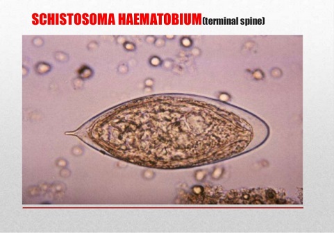 Ad:  schistosomiasis-9-638.jpg
Gsterim: 762
Boyut:  51.8 KB
