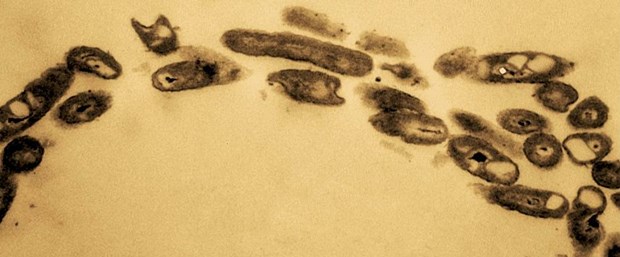 Ad:  petrol-yiyen-bakteriler-okyanuslari-kurtarabilir-mi,pSfsRkdvUECRst72TyaeFA.jpg
Gsterim: 781
Boyut:  41.4 KB