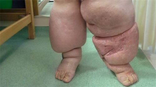 Ad:  filhastala2.JPG
Gsterim: 1231
Boyut:  17.3 KB