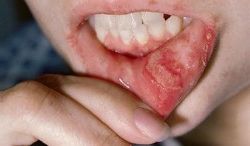 Ad:  behet-hastal.jpg
Gsterim: 570
Boyut:  6.8 KB