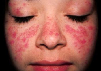 Ad:  lupus.JPG
Gsterim: 536
Boyut:  18.6 KB