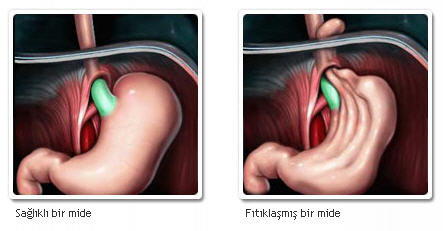 Ad:  refl1.jpg
Gsterim: 2041
Boyut:  20.6 KB