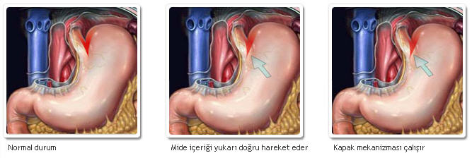 Ad:  refl3.jpg
Gsterim: 1833
Boyut:  34.8 KB